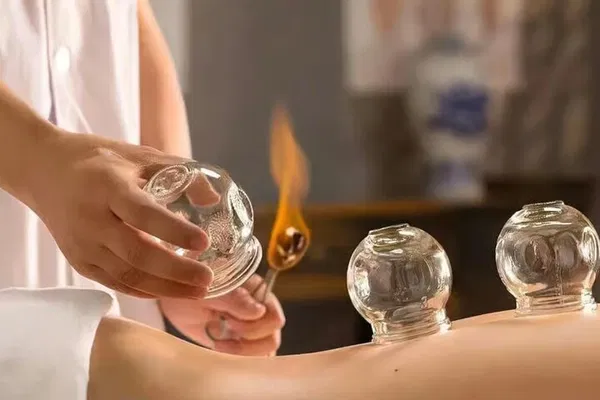 Acupuncture & Suction Cups Session: Relax & Revitalize